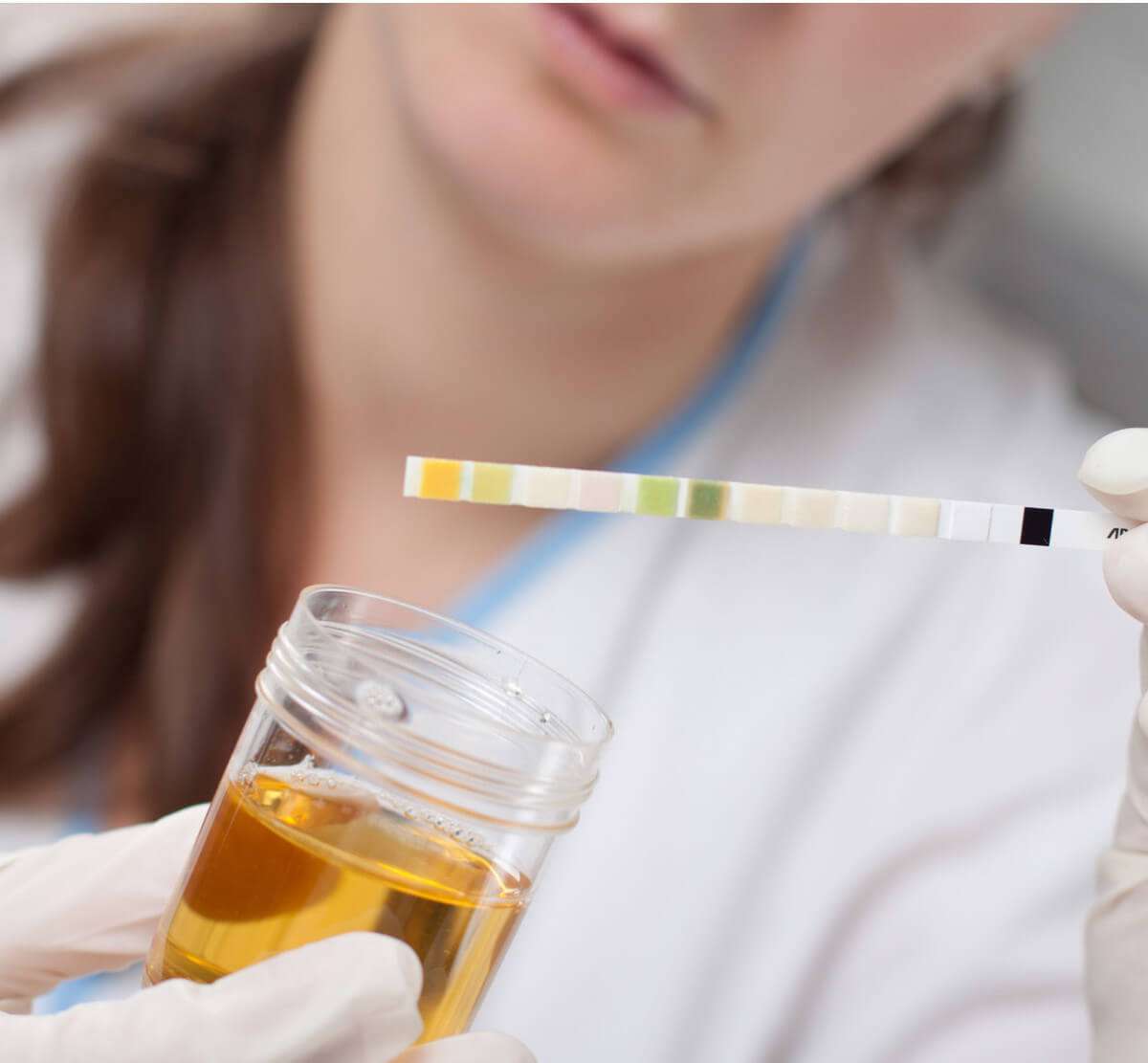 test-urine-farmacia